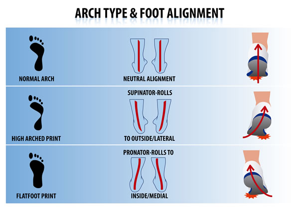 Don’t Fear Foot Pronation