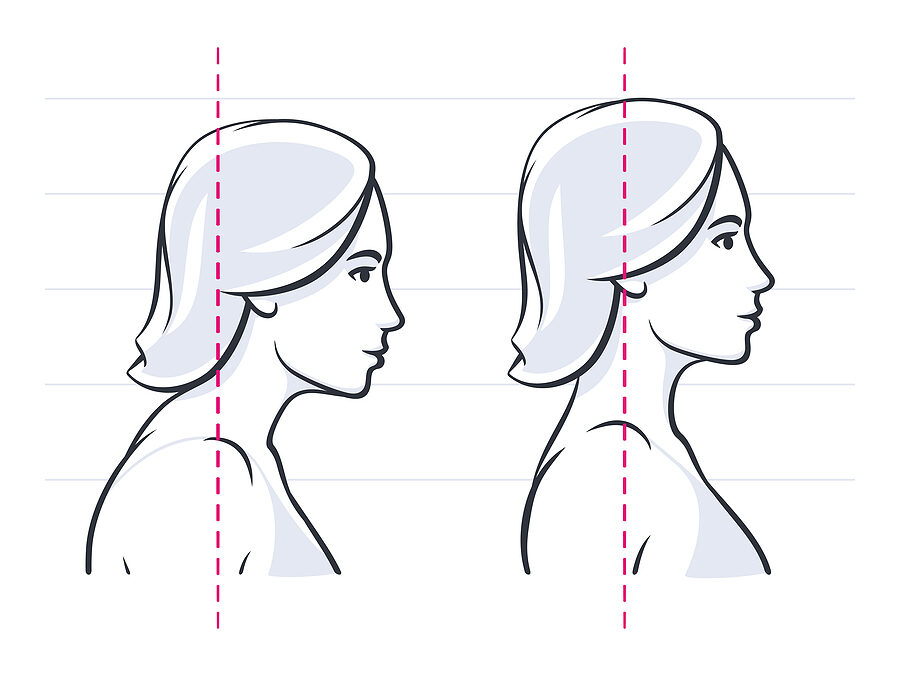 3 Exercises to Relieve Neck Pain